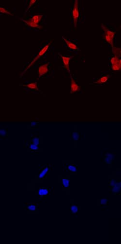 Human NKX3.1 Antibody, R D Systems 100&mu;g; Unlabeled:Antibodies, Polyclonal
