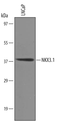 Human NKX3.1 Antibody, R D Systems 100&mu;g; Unlabeled:Antibodies, Polyclonal