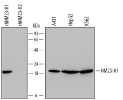 Human NM23-H1 Antibody, R D Systems 100ug; Unlabeled:Antibodies, Monoclonal