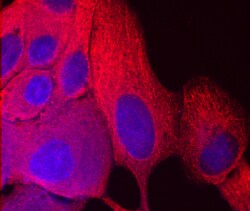 Human/Mouse/Rat NM23-H1/H2 Antibody, R D Systems 100&mu;g; Unlabeled:Antibodies,