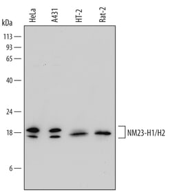 Human/Mouse/Rat NM23-H1/H2 Antibody, R D Systems 100&mu;g; Unlabeled:Antibodies,