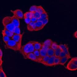 Human NM23-H2 Antibody, R D Systems 100&mu;g; Unlabeled:Antibodies, Polyclonal