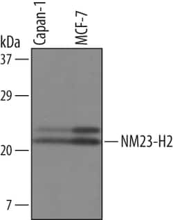 Human NM23-H2 Antibody, R D Systems 100&mu;g; Unlabeled:Antibodies, Polyclonal