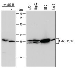 Human/Mouse/Rat NM23-H1/H2 Antibody, R D Systems 25&mu;g; Unlabeled:Antibodies,