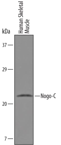 Human Nogo-C Antibody, R D Systems 25&mu;g; Unlabeled:Antibodies, Polyclonal