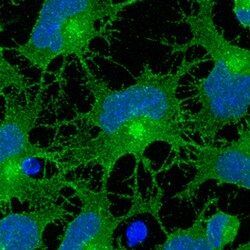 Mouse/Rat Notch-1 Antibody, R D Systems 100&mu;g; Unlabeled:Antibodies,