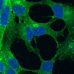 Mouse/Rat Notch-1 Antibody, R D Systems 100&mu;g; Unlabeled:Antibodies,