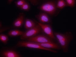 Human Notch-1 Intracellular Domain Antibody, R D Systems 100&mu;g; Unlabeled:Antibodies,