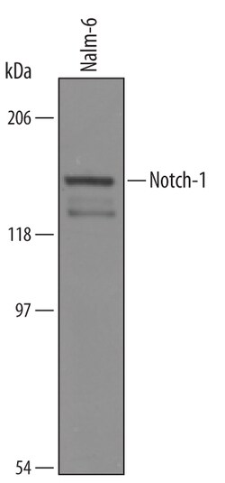 Human Notch-1 Antibody, R D Systems 25&mu;g; Unlabeled:Antibodies, Polyclonal