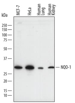 Human NQO-1 Antibody, R D Systems 25&mu;g; Unlabeled:Antibodies, Polyclonal