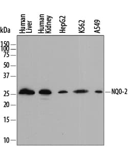 Human NQO-2 Antibody, R D Systems 25&mu;g; Unlabeled:Antibodies, Polyclonal