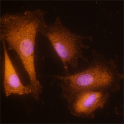 Human/Mouse NRAGE Antibody, R D Systems 25&mu;g; Unlabeled:Antibodies,