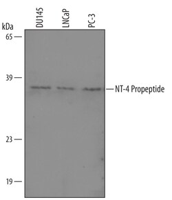 Human NT-4 Propeptide Antibody, R D Systems 100&mu;g; Unlabeled:Antibodies,