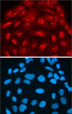 Human/Mouse/Rat Nucleostemin Antibody, R D Systems 25&mu;g; Unlabeled:Antibodies,