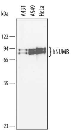 Human Numb Antibody, R D Systems 100&mu;g; Unlabeled:Antibodies, Polyclonal