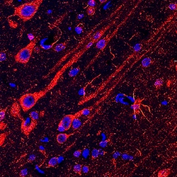 Human/Mouse/Rat N-WASP Antibody, R D Systems 25&mu;g; Unlabeled:Antibodies,
