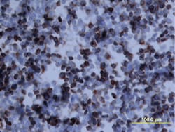 Mouse Osteopontin/OPN Antibody, R D Systems 100&mu;g; Unlabeled:Antibodies,
