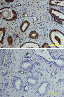 Human Osteoprotegerin/TNFRSF11B Biotinylated Antibody, R D Systems 50&mu;g;