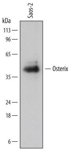 Human Osterix/Sp7 Antibody, R D Systems 25&mu;g; Unlabeled:Antibodies,