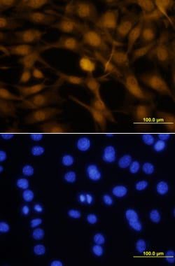 Human Otx2 Antibody, R D Systems 100&mu;g; Unlabeled:Antibodies, Polyclonal