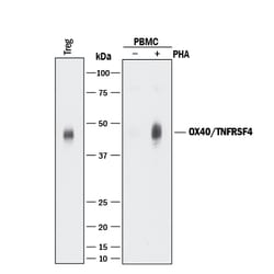 Human OX40/TNFRSF4 Antibody, R D Systems 25&mu;g; Unlabeled:Antibodies,