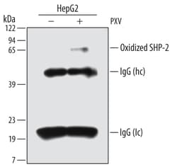 Oxidized PTP Active Site Antibody, R D Systems 25&mu;g; Unlabeled:Antibodies,