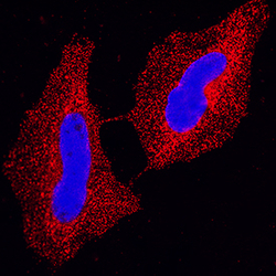 Human p15INK4b/CDKN2B Antibody, R D Systems 25&mu;g; Unlabeled:Antibodies,