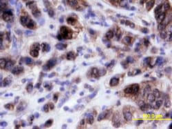 Human p21/CIP1/CDKN1A Antibody, R D Systems 25&mu;g; Unlabeled:Antibodies,