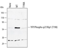 Human Phospho-p27/Kip1 (T198) Antibody, R D Systems 100&mu;g; Unlabeled:Antibodies,