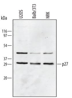 Human/Mouse/Rat p27/Kip1 Antibody, R D Systems 100ug; Unlabeled:Anticorps,