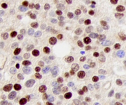 Human/Mouse/Rat p27/Kip1 Antibody, R D Systems 100ug; Unlabeled:Antibodies,