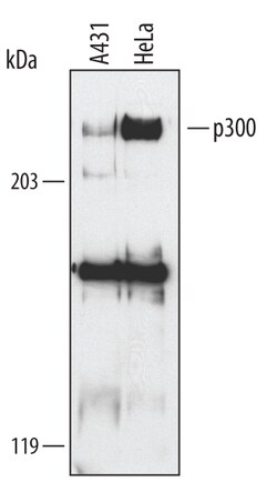 Human p300 Antibody, R D Systems 100&mu;g; Unlabeled:Antibodies, Polyclonal