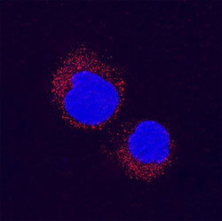 Human p38 beta/MAPK11 Antibody, R D Systems 100ug; Unlabeled:Antibodies,