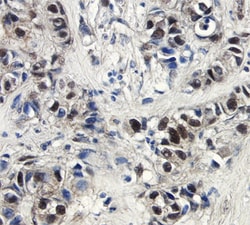 Human Phospho-p53 (S15) Antibody, R D Systems 25&mu;g; Unlabeled:Antibodies,