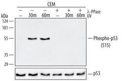 Human Phospho-p53 (S15) Antibody, R D Systems 25&mu;g; Unlabeled:Antibodies,