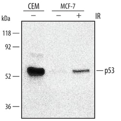 Human/Mouse/Rat p53 Antibody, R D Systems 100&mu;g; Unlabeled:Antibodies,