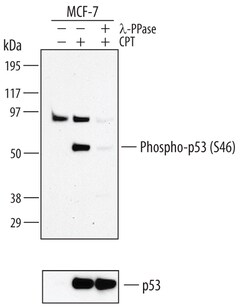 Human Phospho-p53 (S46) Antibody, R D Systems 100&mu;g; Unlabeled:Antibodies,