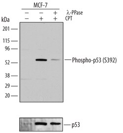 Human Phospho-p53 (S392) Antibody, R D Systems 25&mu;g; Unlabeled:Antibodies,