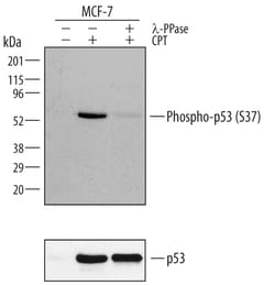 Human Phospho-p53 (S37) Antibody, R D Systems 50&mu;g; Unlabeled:Antibodies,