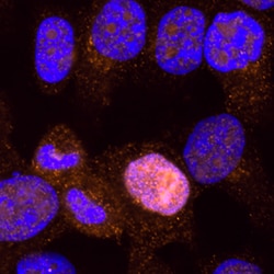 Human/Mouse/Rat p53 Antibody, R D Systems 25&mu;g; Unlabeled:Antibodies,