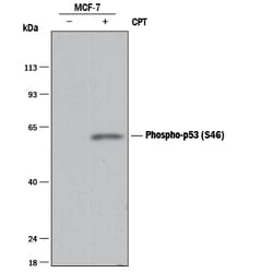 Human Phospho-p53 (S46) Antibody, R D Systems 25 &mu;g; Unconjugated:Antibodies,