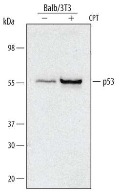 Mouse p53 Antibody, R D Systems 25&mu;g; Unlabeled:Antibodies, Monoclonal