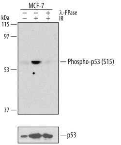 Phospho-p53 (S15) Mouse anti-Human, Clone: 261352, R D Systems 100 &mu;g | Buy Online | R&D Systems | Fisher Scientific