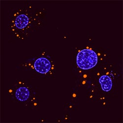 Human/Mouse/Rat p62/SQSTM1 Biotinylated Antibody, R D Systems 50ug; Biotin:Antibodies,