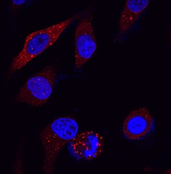 Human/Mouse/Rat p62/SQSTM1 Antibody, R D Systems 25&mu;g; Unlabeled:Antibodies,