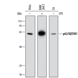 Human/Mouse/Rat p62/SQSTM1 Antibody, R D Systems 25&mu;g; Unlabeled:Antibodies,