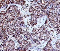 Human p63/TP73L Antibody, R D Systems 25&mu;g; Unlabeled:Antibodies, Polyclonal