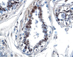 Human/Mouse/Rat p70 S6 Kinase Antibody, R D Systems 25&mu;g; Unlabeled:Antibodies,