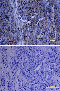 Human/Mouse/Rat p70 S6 Kinase Antibody, R D Systems 25&mu;g; Unlabeled:Antibodies,