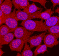 Human p70 S6 Kinase beta Antibody, R D Systems 25&mu;g; Unlabeled:Antibodies,
